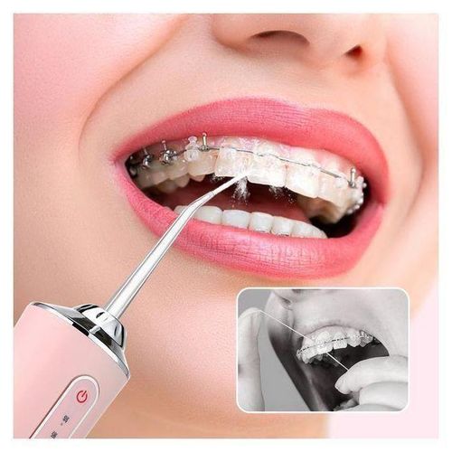 Irrigateur Oral Portable — Jet Dentaire 3 Modes